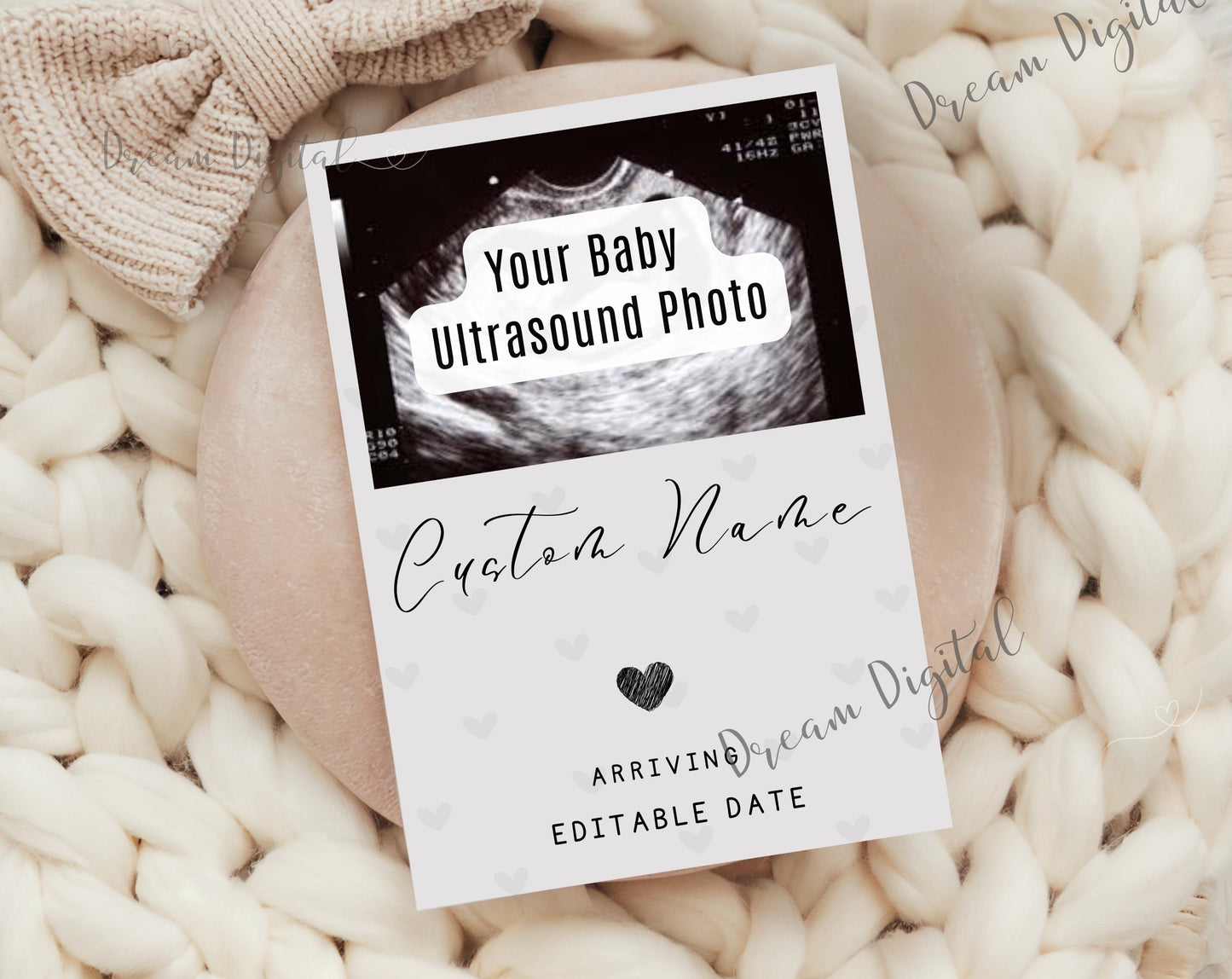 Digital Minimalist Pregnancy Announcement Template | Editable Modern Baby Reveal | Social Media Reveal | Neutral Baby Announcement Ideas